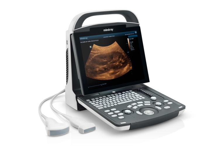 Diagnostic Ultrasound System, DP-10