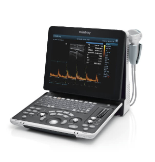 Diagnostic Ultrasound System, DP-50