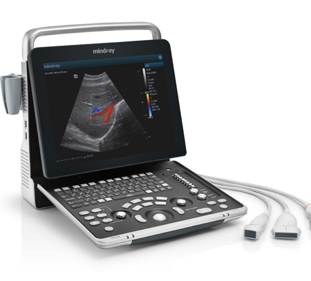 Diagnostic Ultrasound System, Z60