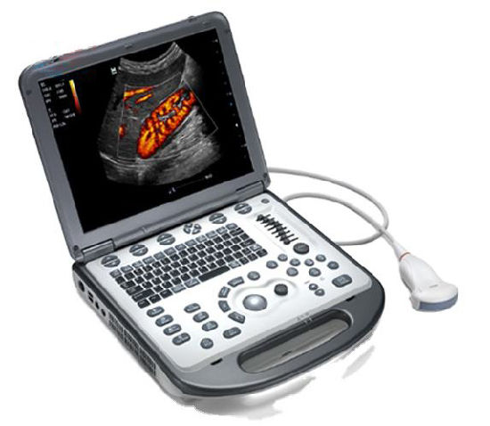 Diagnostic Ultrasound System, M6