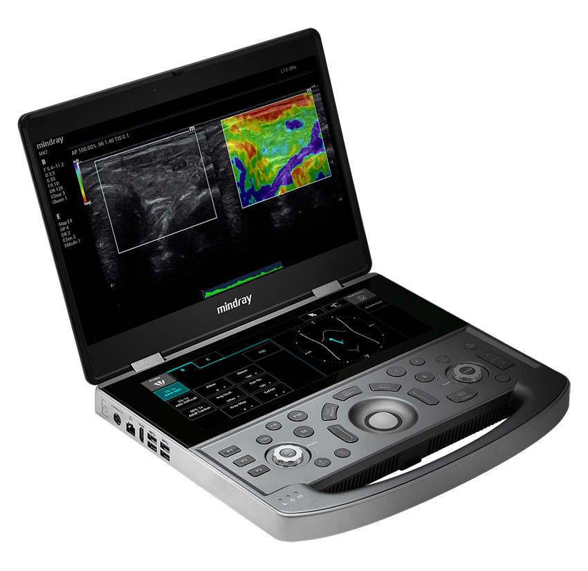 Diagnostic Ultrasound System, MX7