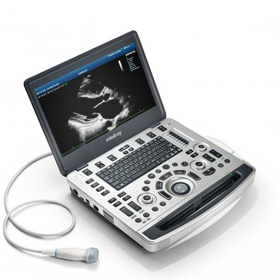 Diagnostic Ultrasound System, M9